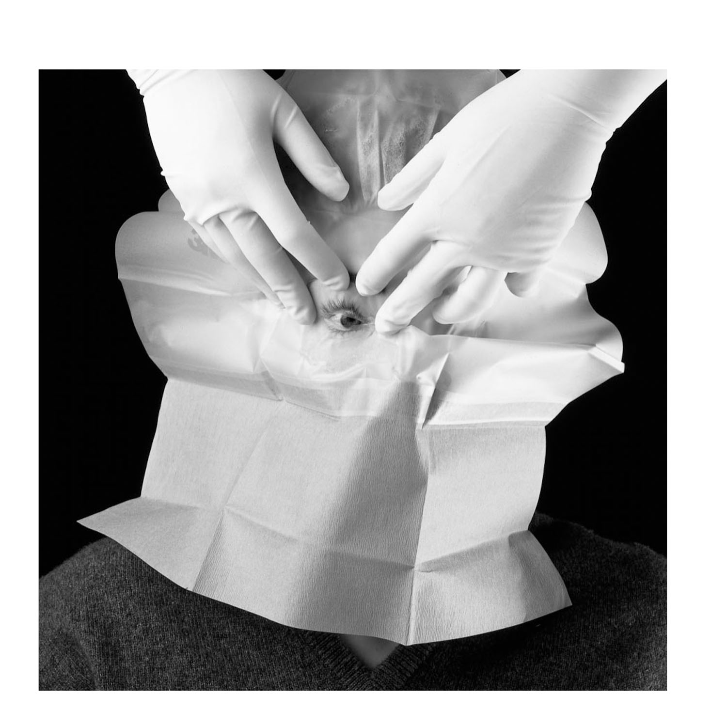 SOLVENTUM STERI-DRAPE OPHTHALMIC SURGICAL DRAPES : 1022 CS $245.33 Stocked