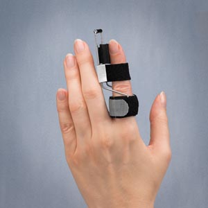 3 POINT PRODUCTS SIDE STEP FINGER SPLINTS : P1201-3 EA                                                                                                                                                                                                       